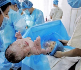 试管婴儿孩子会有缺陷吗